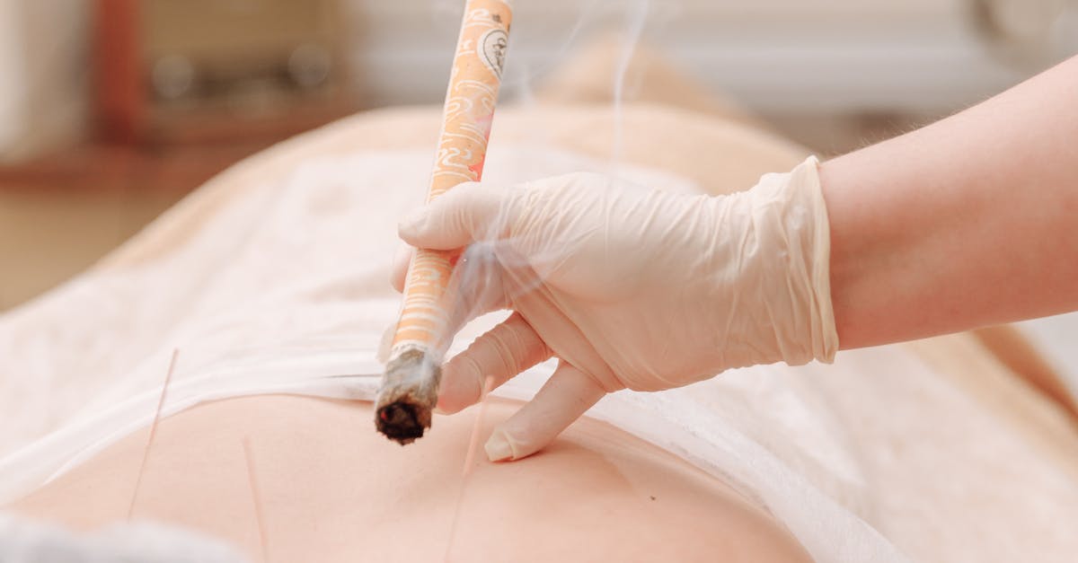 Acupuncture for Back Pain Relief: A Comprehensive Guide