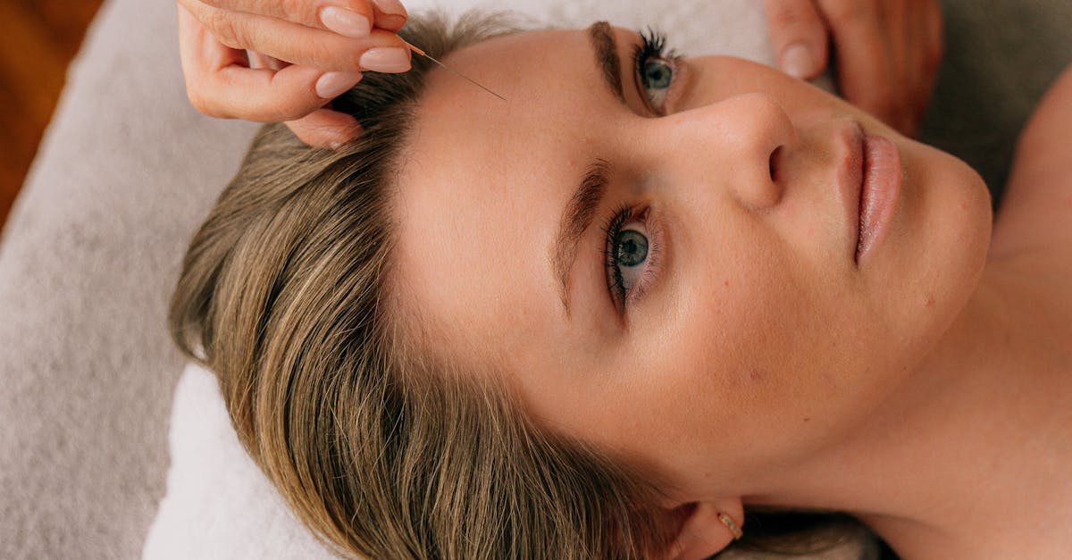 Essential Queries to Prioritise When Selecting an Acupuncturist in Melbourne