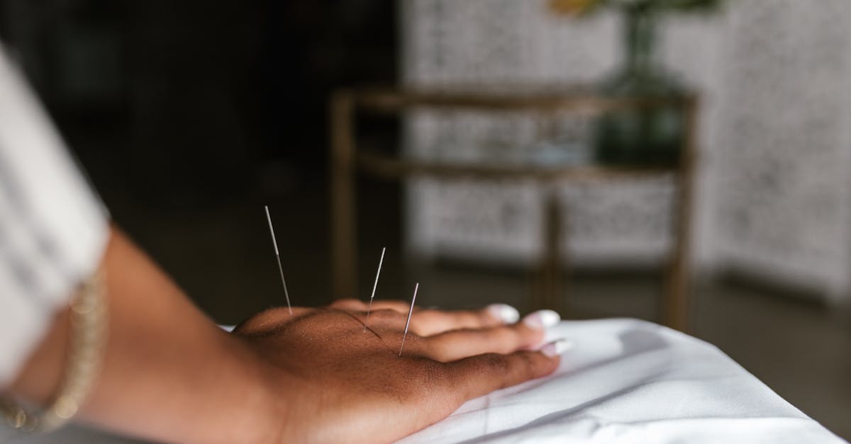 Financial Assistance Options for Acupuncture Treatments in Melbourne
