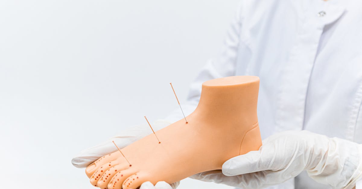 What to Expect During Your First Electro-Acupuncture Session